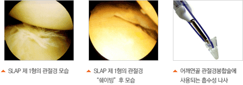 ȸÀü±Ù°³ ÆÄ¿