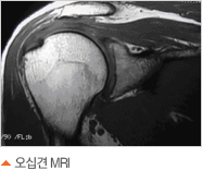 ¿À½Ê°ßMRI