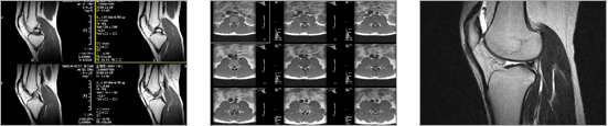 MRI