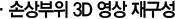 ¼Õ»óºÎÀ§ 3D ¿µ»ó À籸¼º
